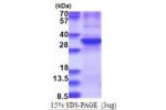 ZNF32, 1-273aa, Human