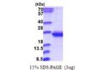RWDD4, 1-188aa, Human