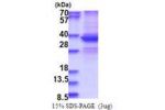 DDX39A, 1-249aa, Human