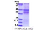 DYRK1A, 159-479aa, Human