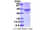 ASPHD1, 96-390aa, Human