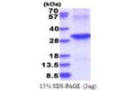 ABHD12B, 1-255aa, Human