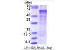 LMX1B, 1-395aa, Human