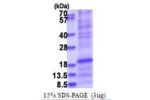 SFTPD, 224-375aa, Human