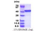 LANCL1, 1-399aa, Human