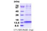OXLD1, 46-147aa, Human