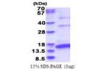HCV-NS5a, 2210-2306aa, Hepatitis C Virus