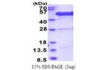 BCCIP, 1-314aa, Human
