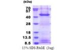 FBXO2, 1-296aa, Human