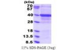 DENV, 298-400aa, Dengue virus 2