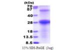 HCV-E2, 482-671aa, HCV