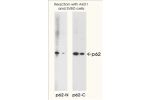 Anti-p62 Protein, C-Terminal Specific Polyclonal Antibody