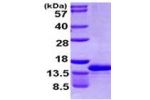 CCL4L1, 24-92aa, Human, His tag, E.coli