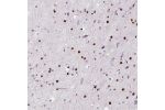 Immunohistochemical staining of human cerebral cortex shows strong nuclear positivity in neurons.