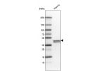 Western blot analysis in human plasma.