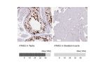 Immunohistochemistry analysis in human testis and skeletal muscle tissues using AMAb90541 antibody. Corresponding ATAD2 RNA-seq data are presented for the same tissues.