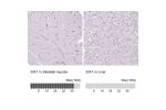 Immunohistochemistry analysis in human skeletal muscle and liver tissues using AMAb90544 antibody. Corresponding SIX1 RNA-seq data are presented for the same tissues.