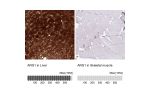 Immunohistochemical staining of human liver shows strong nuclear and cytoplasmatic positivity in hepatocytes.