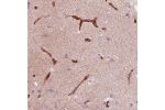 Immunohistochemical staining of human cerebral cortex shows strong immunoreactivity in the endothelial cells.