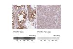 Immunohistochemistry analysis in human testis and pancreas tissues using AMAb90565 antibody. Corresponding PCM1 RNA-seq data are presented for the same tissues.