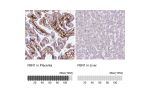 Immunohistochemical staining of human testis shows strong immunoreactivity in the extracellular matrix of seminiferous tubules.