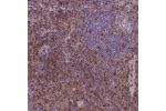Immunohistochemical staining of human tonsil shows strong cytoplasmic positivity, mainly in non - germinal center cells.