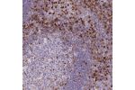 Immunohistochemical staining of human tonsil shows moderate to strong cytoplasmic positivity, mainly in in non - germinal center cells.