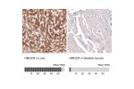 Immunohistochemistry analysis in human liver and skeletal muscle tissues using AMAb90619 antibody. Corresponding HMGCR RNA-seq data are presented for the same tissues.
