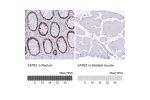 Immunohistochemistry analysis in human rectum and skeletal muscle tissues using AMAb90635 antibody. Corresponding SATB2 RNA-seq data are presented for the same tissues.