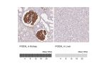 Immunohistochemistry analysis in human kidney and liver tissues using AMAb90643 antibody. Corresponding PODXL RNA-seq data are presented for the same tissues.