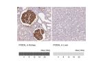 Immunohistochemistry analysis in human kidney and liver tissues using AMAb90644 antibody. Corresponding PODXL RNA-seq data are presented for the same tissues.