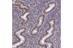 Immunohistochemical staining of human endometrium shows moderate to strong nuclear positivity in glandular and stromal cells.