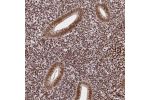 Immunohistochemical staining of human endometrium shows moderate nuclear positivity in glandular and stromal cells.