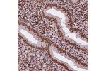 Immunohistochemical staining of human endometrium shows strong nuclear positivity in glandular and stromal cells.