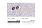 Immunohistochemistry analysis in human kidney and liver tissues using AMAb90667 antibody. Corresponding PODXL RNA-seq data are presented for the same tissues.