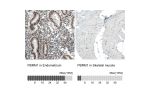 Immunohistochemistry analysis in human endometrium and skeletal muscle tissues using AMAb90690 antibody. Corresponding PBRM1 RNA-seq data are presented for the same tissues.