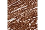 Immunohistochemical staining of human liver shows moderate cytoplasmic positivity in the hepatocytes.