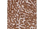 Immunohistochemical staining of human liver shows strong granular cytoplasmic immunoreactivity in hepatocytes.