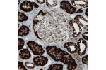 Immunohistochemical staining of human kidney shows strong cytoplasmic positivity in renal tubules.