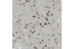 Immunohistochemical staining of human cerebral cortex shows strong immunoreactivity in neuronal cells.