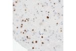 Immunohistochemical staining of human cerebral cortex shows nuclear immunoreactivity in a subset of neurons.