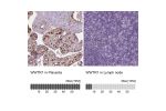 Immunohistochemistry analysis in human placenta and lymph node tissues using AMAb90730 antibody. Corresponding WWTR1 RNA-seq data are presented for the same tissues.