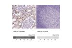 Immunohistochemistry analysis in human kidney and tonsil tissues using AMAb90733 antibody. Corresponding HNF1B RNA-seq data are presented for the same tissues.