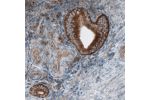 Immunohistochemical staining of human uterus shows cytoplasmic immunoreactivity in the glandular epithelium cells.
