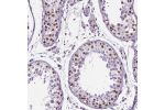 Immunohistochemical staining of human testis shows moderate to strong nuclear positivity in cells in seminiferous ducts.