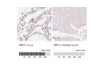 Immunohistochemical staining of human lung shows strong immunoreactivity in macrophages.