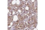 Immunohistochemical staining of human cerebral cortex shows moderate to strong cytoplasmic positivity in glial cells.