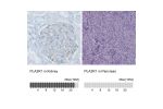 Immunohistochemistry analysis in human kidney and pancreas tissues using AMAb90772 antibody. Corresponding PLA2R1 RNA-seq data are presented for the same tissues.