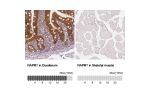 Immunohistochemical staining of human kidney shows strong cytoplasmic immunoreactivity in renal tubules.