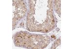 Immunohistochemical staining of human cerebral cortex shows moderate to strong cytoplasmic positivity in neuronal cells, as well as positivity in neuropil.